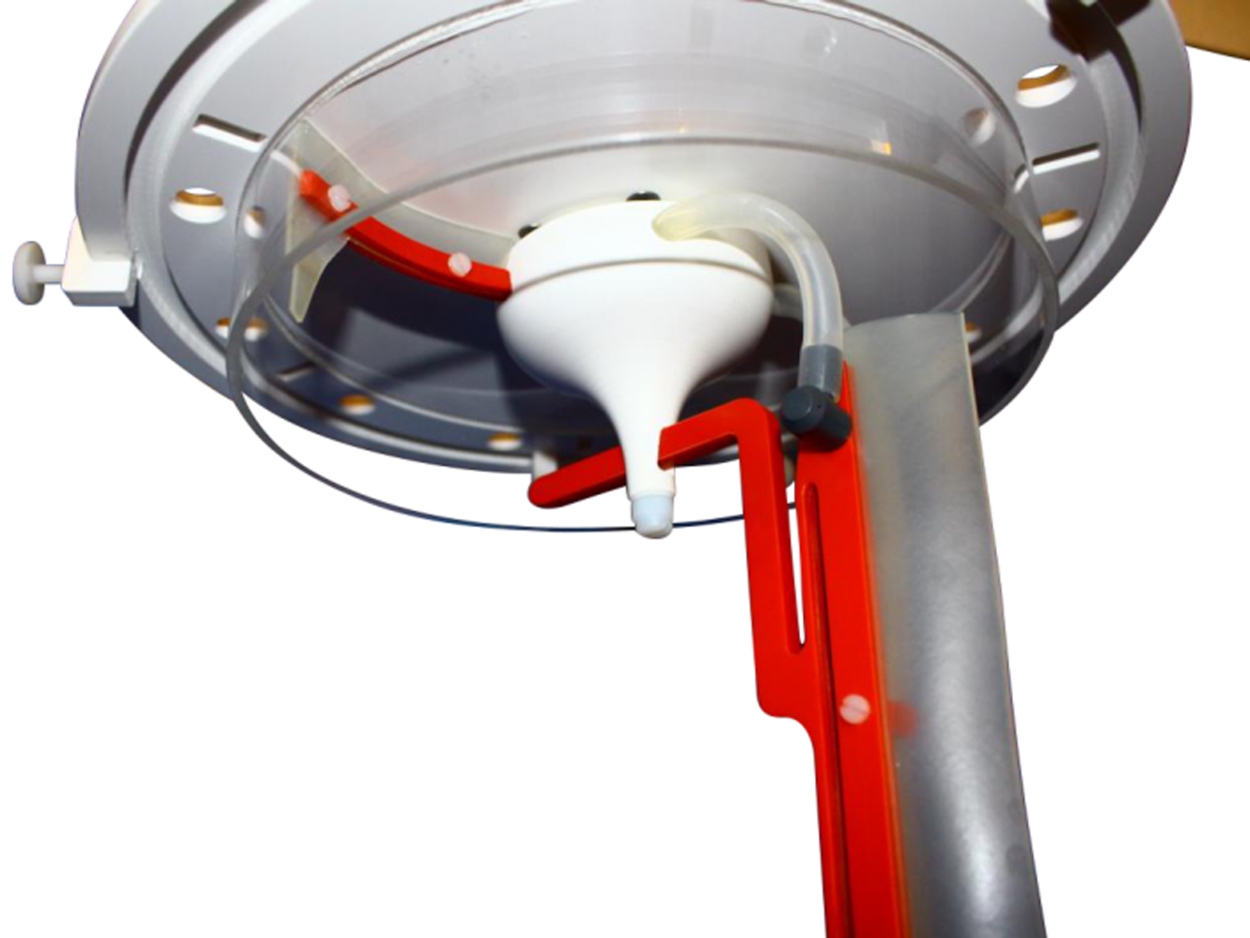 AQUADRIVER® SkimClean HELIX automatischer Abschäumer - Topfreiniger